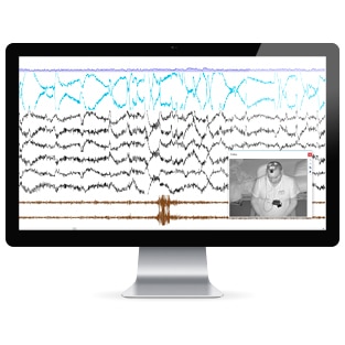 noxturnal-software-recording-video-resmed